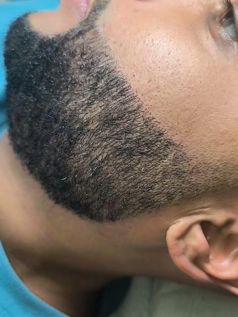Barba completa vista de perfil