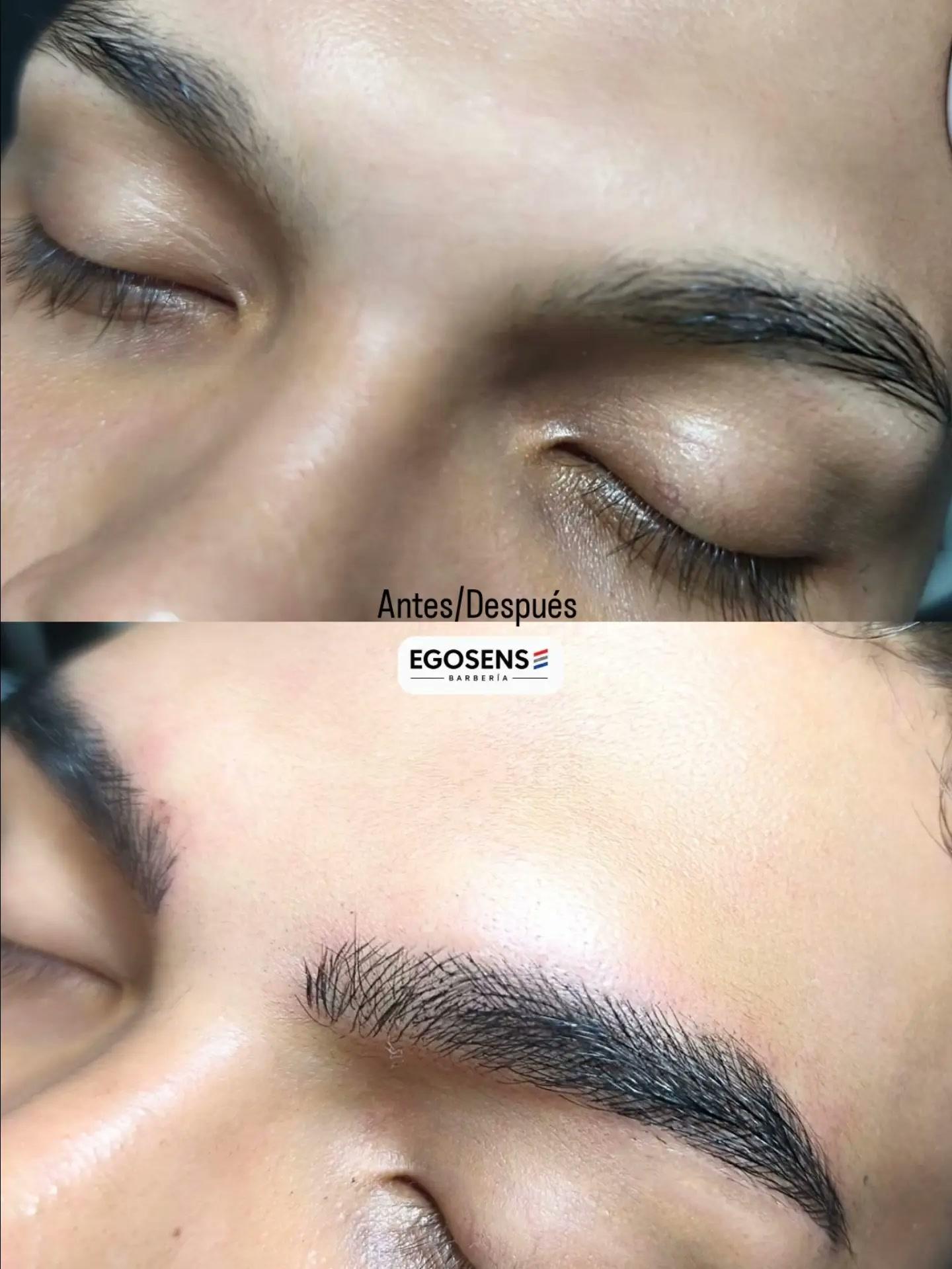 Cejas antes y después del tratamiento